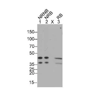 Lupus La Protein (SSB) Antibody [AP3D5] | Apical Lab